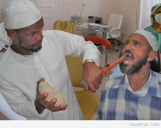 nho rang the nay moi phe